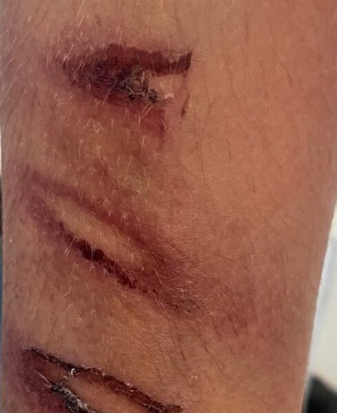Homem suspeito de agredir enteado de 10 anos é solto em Araçatuba